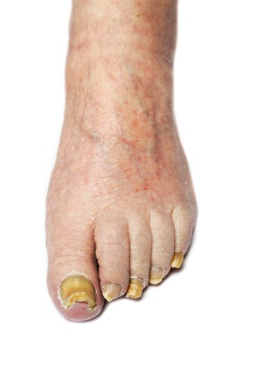 I Stock 000020573285 X Small