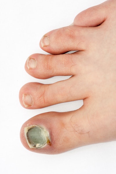 I Stock 000021608199 Small