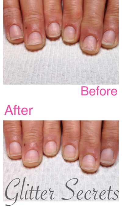 Amanda Lecluse Chemo Client 0