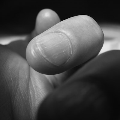 Flickr Image Chemo Nails