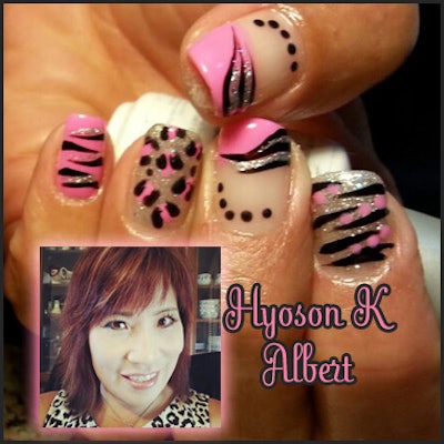 Hyoson Albert Composite