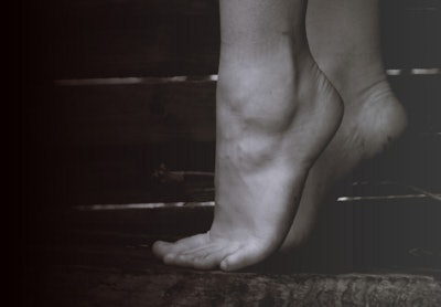 Cracked Foot Fissures About