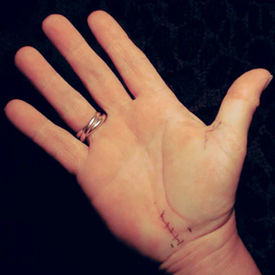 Cts Stitches
