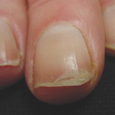 Nailclinic Crackingup