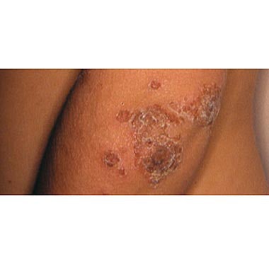 Nailclinic Staphmeeting