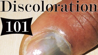 Np Cover Nail Discoloration Means