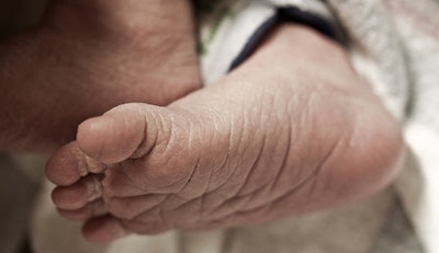 Wrinkled Feet Thick Nails