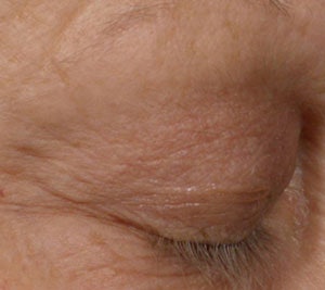 Beautifeye T2months V111