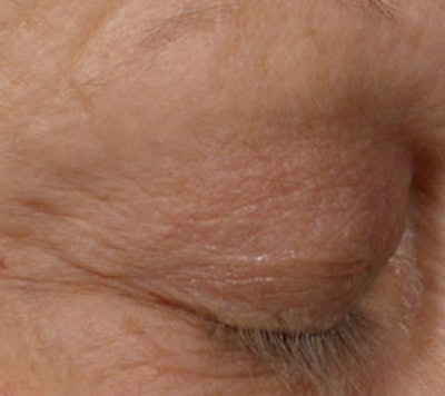 Beautifeye T2months V111