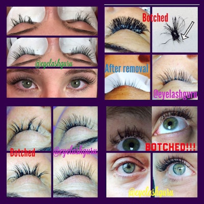 Image courtesy of Emily Phelps Botched lashes, corrected by Phelps