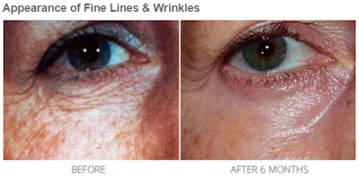 A before and after picture of Environ