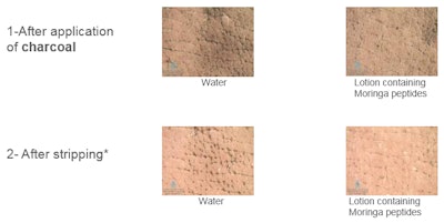 Skin before and after treatment