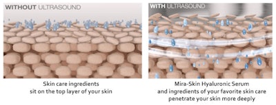 A comparison with Ultrasound