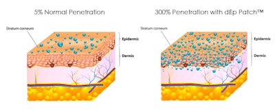 A picture of penetration