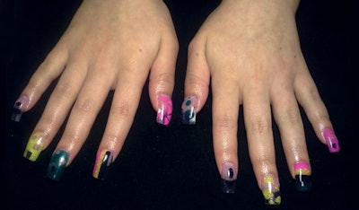 GLOSSIES-KM-DSN-Overall