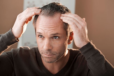 Hair Restoration: Interview with Hair Loss Specialist Bill Edwards | Beauty  Launchpad