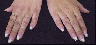 glossies-2017-chantel-brands