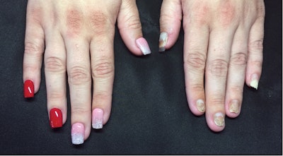 nail-glossies-stephanie-horner