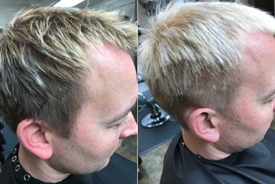 Cutting Thinning Hair