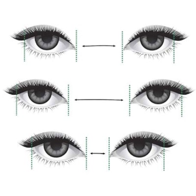 Eye Width