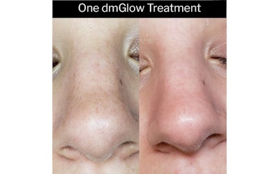 Dermamed Si1901 Image11