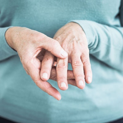 treating-trigger-finger