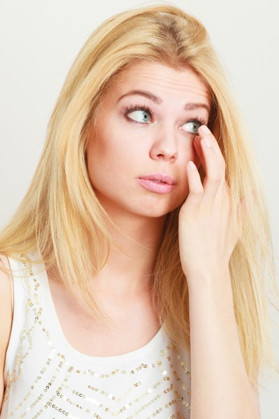 Eyelash Allergy Reaction