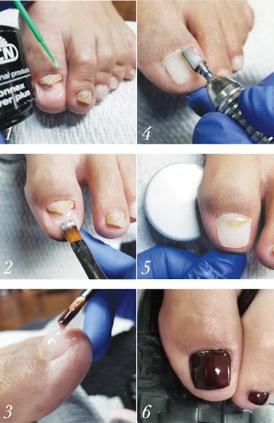 nail-repair-instuctions