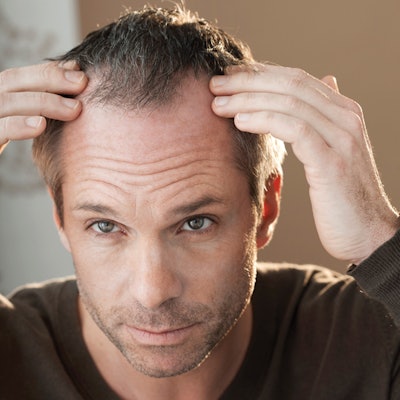 Hair Loss Tips