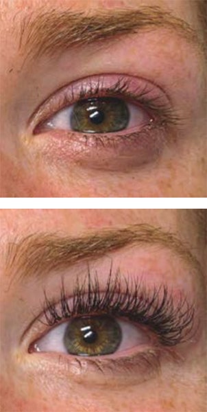 Lashes Before After