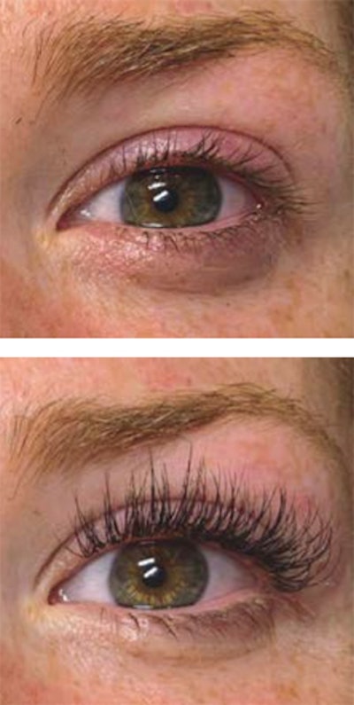 Lashes Before After