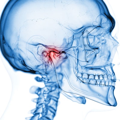 temporomandibular-joint-disorder