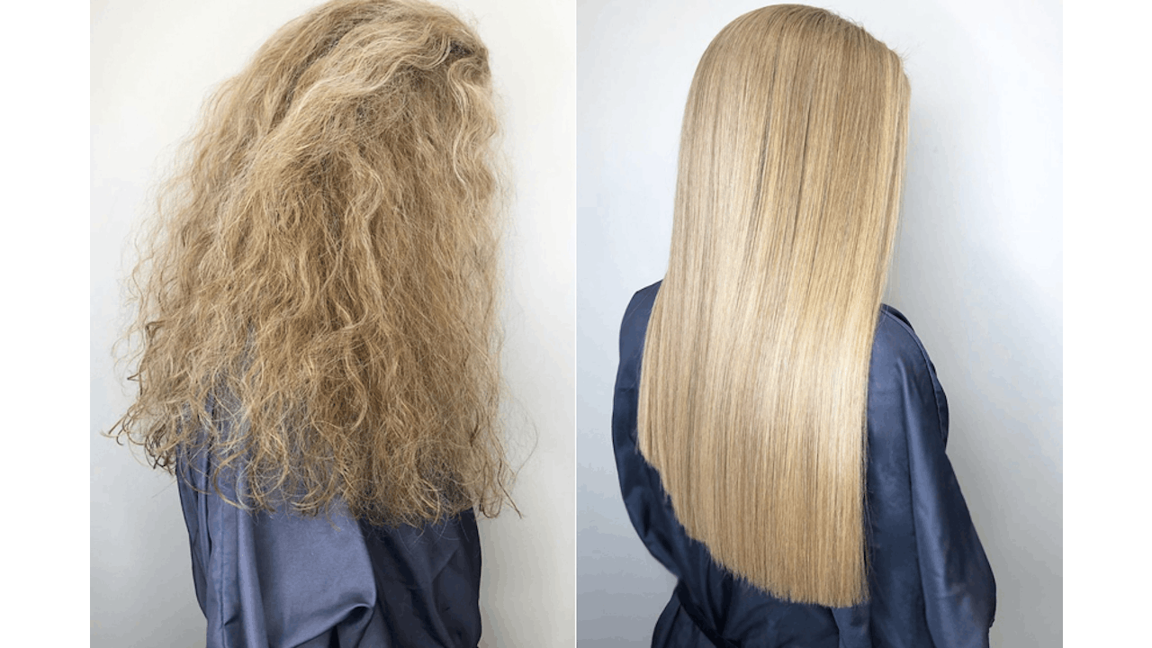 Kera sales therapy treatment