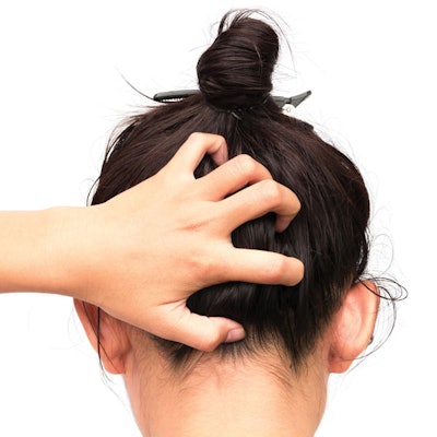 Scalp Issues