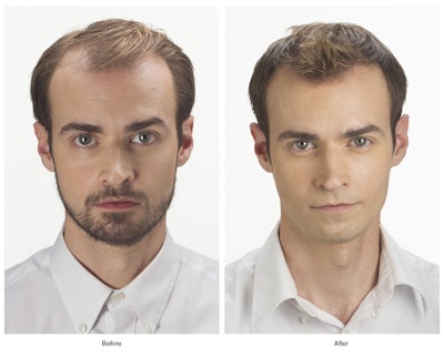 Micropoint Solutions