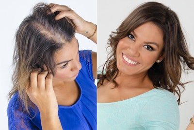 Micropoint Treatment