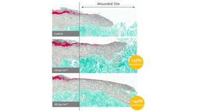 Epi-OnTM is an intensely restorative active conferring a fast recovery following trauma for weakened skin through the epigenetic histone modification pathway. The data shows it accelerates cutaneous healing mechanisms in both the epidermis and dermis layers of human skin.