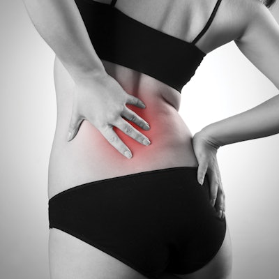 sciatica-information