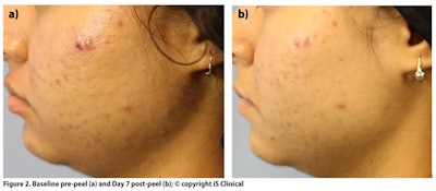 DeHaven_Peels_Figure2