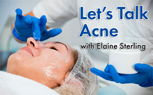 lets_talk_acne_image_72-300X188