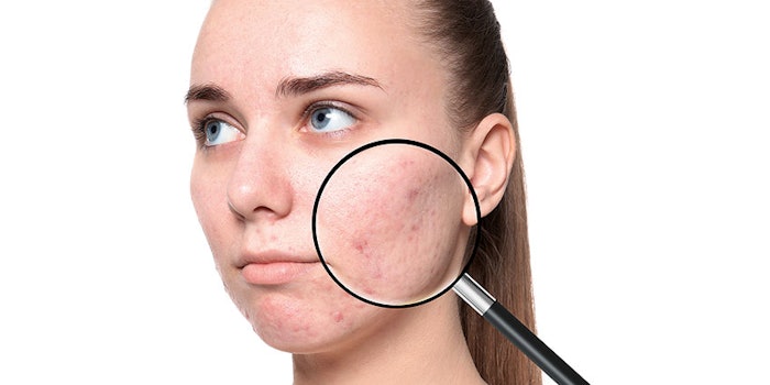 CT2010_Prod_Vevy_Europe_Spa_Azamide_850x425