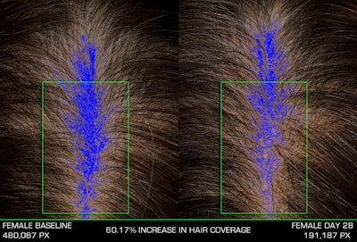 Moroccan Gold Series My NuDo Shampoo, Before and After