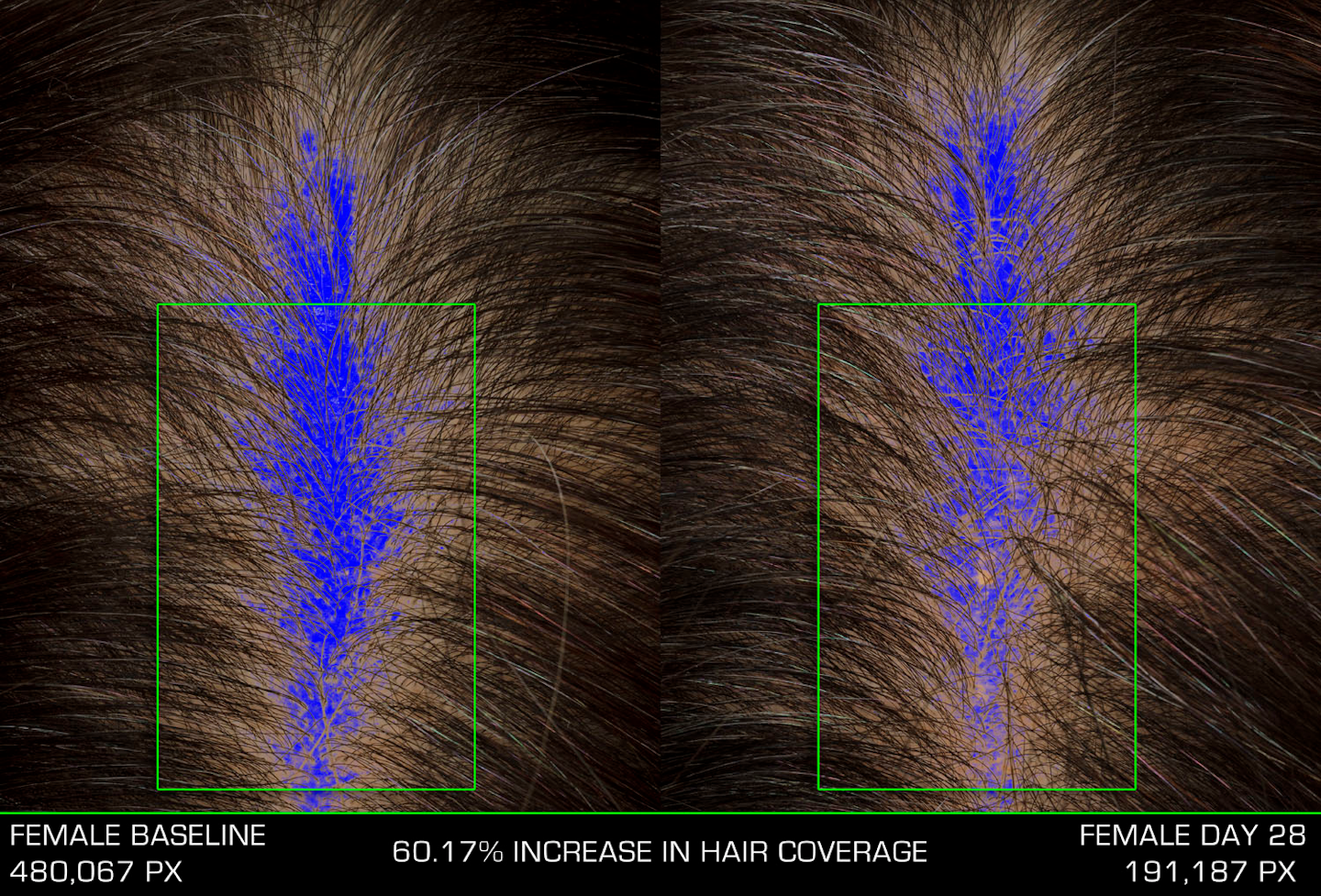 סדרת הזהב המרוקאית שמפו NuDo שלי, לפני ואחרי