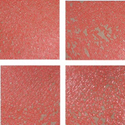 Figure 4 Fishtail lines of the right side of face before (Left) and after (Right) 4 weeks’ application.