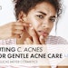Anti-acne-Dendriclear-Lucas_Meyer_Podcast_850X425