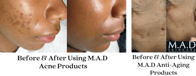 M a Blp2106 Image3 Or