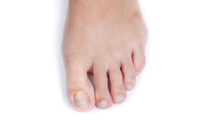 Dreamstime Xxl 46578244