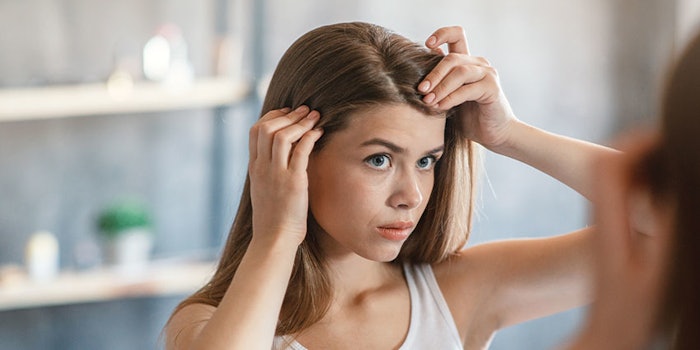 Blp210708 Hair Loss 850x425