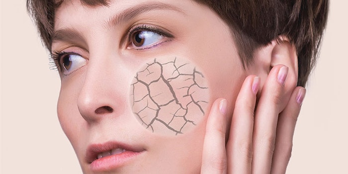 CT2110_Prod_Filagrinol_Vevy_Europe_Spa_850x425