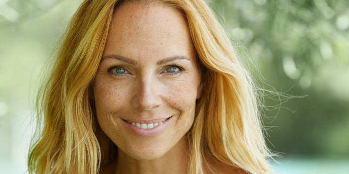 RonaCare Epintegrity offers a composition of selected natural amino acids and components of the NMF.